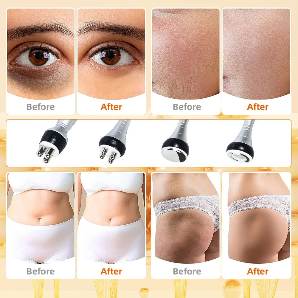 4-in-1 Cavitation Body Slimming Massage Device